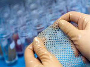 Transplantatie huid